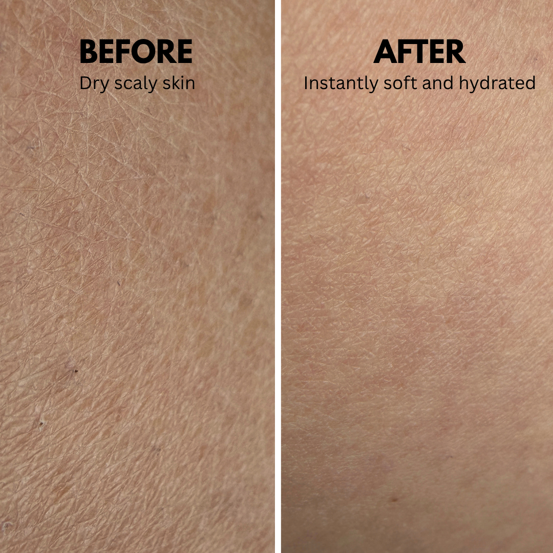 Lisse Body Lotion